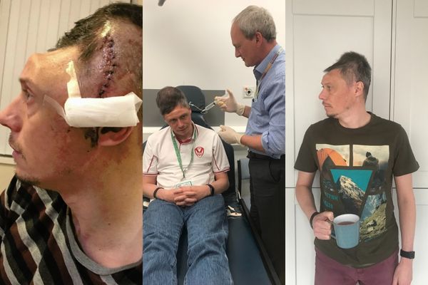 A craniotomy – ‘the last resort’