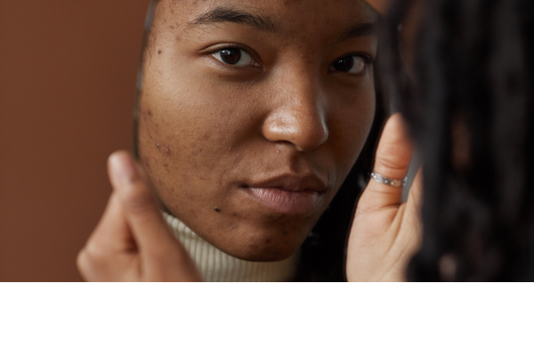 Being seen and accepted after brain injury