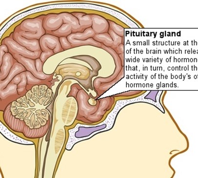 Prevalence of hypopituitarism and growth hormone deficiency in adults long-term after severe TBI Main Image