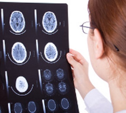 Diagnosing disorders of consciousness using brain networks Main Image