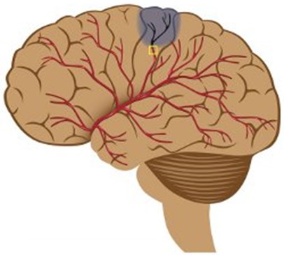 Mapping the way to recovery Main Image