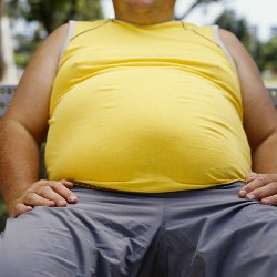 Stroke risk linked to obesity Main Image