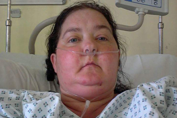 Mother with inoperable brain tumour turns life around to manage Headway shop Main Image